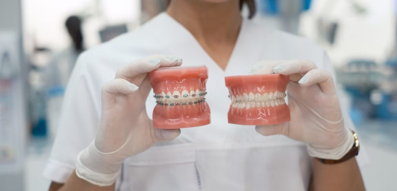 Dentist holding two dental models, one with braces and one without