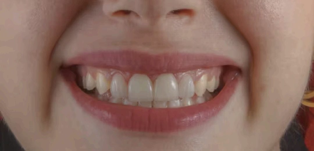 Close-up of a bright, healthy smile